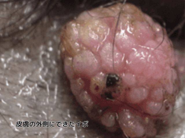 トイプードル 悪性イボ 外側にできた皮膚のイボ